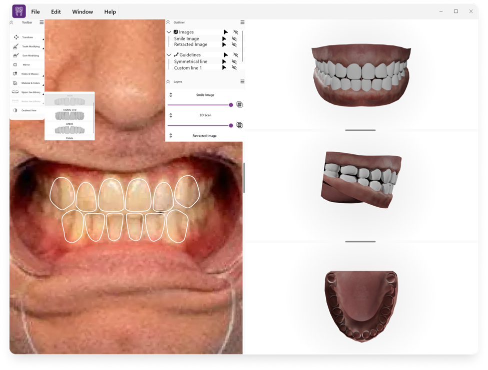 2D/3D dental software interface showing split view with 2D dental photography and 3D models
