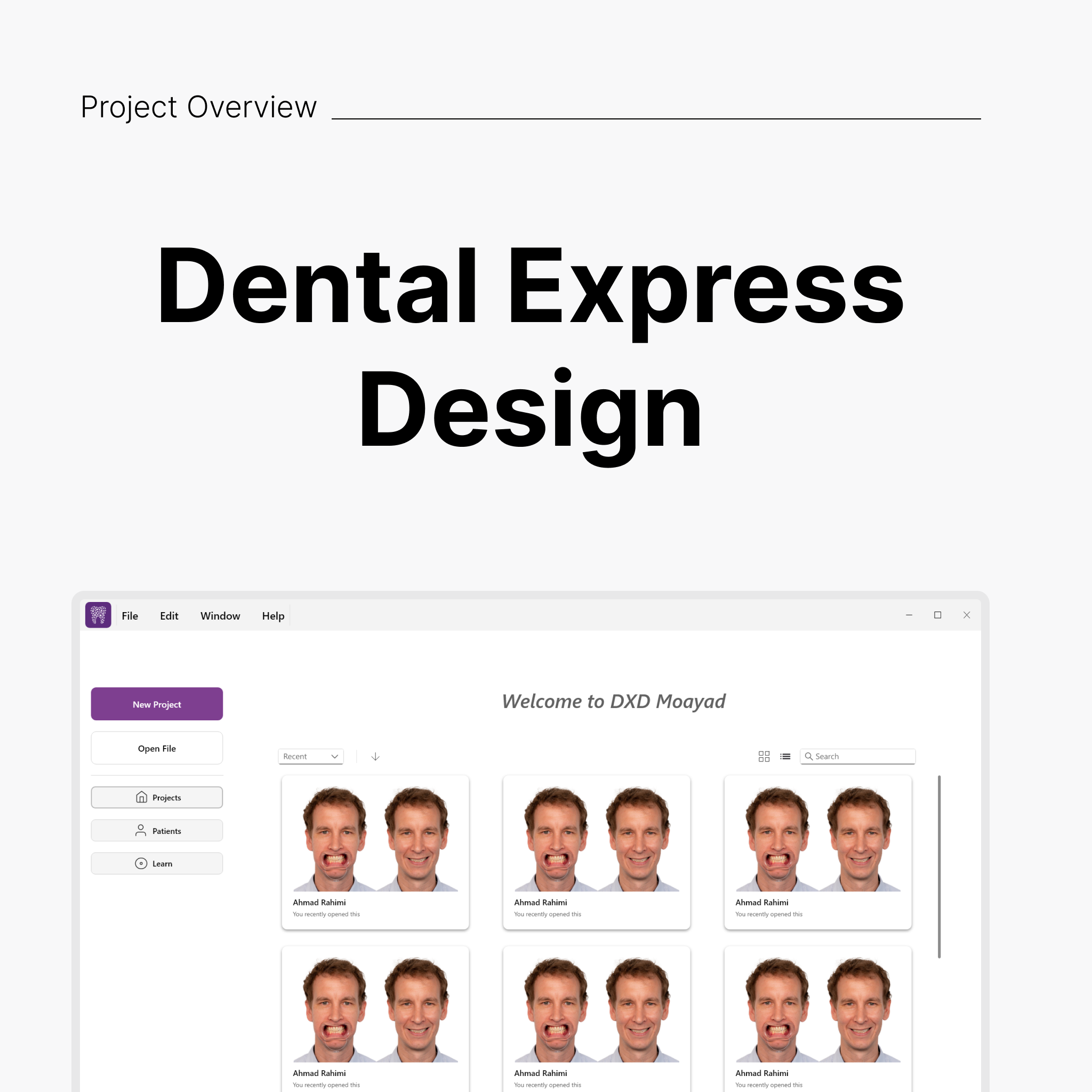 Dental Express Design Project Overview