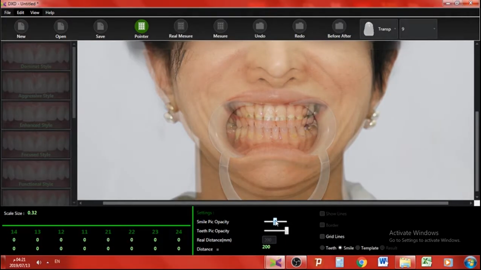 Dental software interface showing patient smile analysis