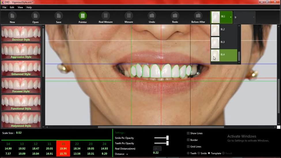 Dental software with smile design templates and measurement tools