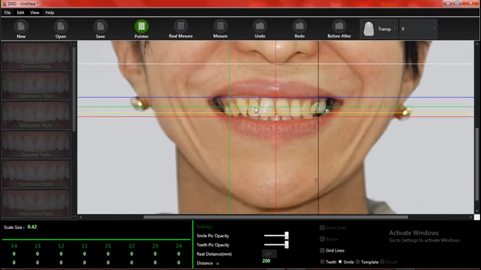 Dental software measurement and analysis interface
