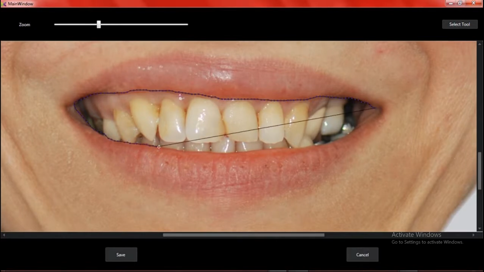 Close-up view of dental analysis results