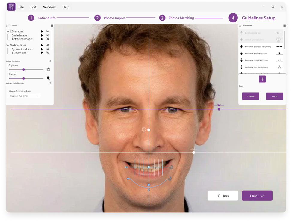 Dental software guideline setup interface with patient photo and reference points