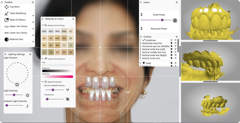 Comprehensive dental software interface combining 2D patient photos with 3D dental models for faster design workflow